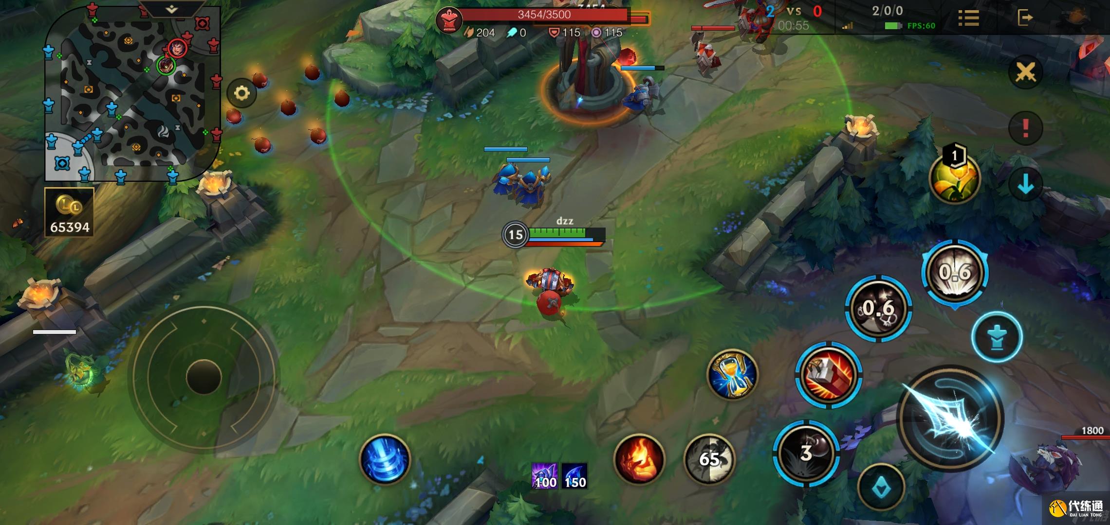 英雄联盟手游炸弹人怎么出装